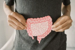 Colon Cancer